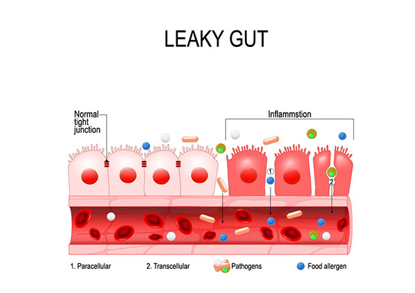 Leaky Gut Specialist Madison MS
